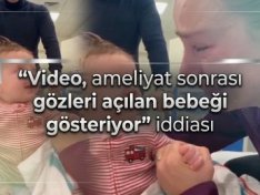 "Video, ameliyat sonrası gözleri açılan bebeği gösteriyor" iddiası