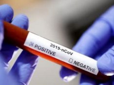 Millət vəkili: “Dünyada koronavirusa təkrar yoluxma halı 1 %-dən azdır”