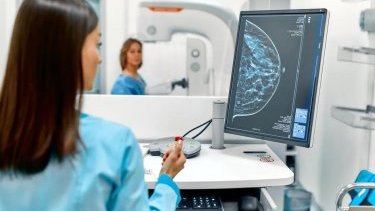 Правда ли, что маммография — эффективный метод онкоскрининга?